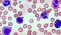 Leukocyte slide | Recurso educativo 60616