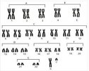 Los cromosomas humanos | Recurso educativo 72236