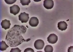 Glóbulo Blanco Persiguiendo a una Bacteria | Recurso educativo 737699