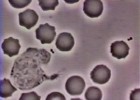Glóbulo Blanco Persiguiendo a una Bacteria | Recurso educativo 737699