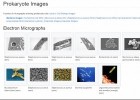 Prokaryote Images | Recurso educativo 773857